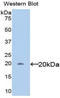 Interleukin 6 Signal Transducer antibody, LS-C298712, Lifespan Biosciences, Western Blot image 