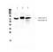 ADAM Metallopeptidase Domain 17 antibody, A00604, Boster Biological Technology, Western Blot image 