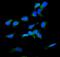 RDX antibody, A01926-1, Boster Biological Technology, Immunofluorescence image 