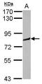 Murine Retrovirus Integration Site 1 Homolog antibody, GTX123277, GeneTex, Western Blot image 