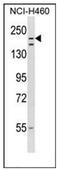 Listerin E3 Ubiquitin Protein Ligase 1 antibody, AP53685PU-N, Origene, Western Blot image 