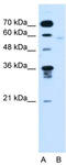 Flavin Containing Dimethylaniline Monoxygenase 3 antibody, TA335295, Origene, Western Blot image 