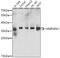 Heterogeneous Nuclear Ribonucleoprotein A1 antibody, 22-980, ProSci, Western Blot image 