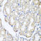 Putative adenosylhomocysteinase 2 antibody, LS-C409322, Lifespan Biosciences, Immunohistochemistry paraffin image 