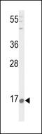 Prepronociceptin antibody, 63-889, ProSci, Western Blot image 