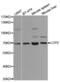 Lymphocyte Cytosolic Protein 2 antibody, MBS126878, MyBioSource, Western Blot image 