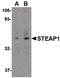 STEAP Family Member 1 antibody, PA5-20403, Invitrogen Antibodies, Western Blot image 