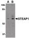 STEAP Family Member 1 antibody, PA5-20403, Invitrogen Antibodies, Western Blot image 