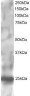 Regulator Of G Protein Signaling 1 antibody, PA5-18040, Invitrogen Antibodies, Western Blot image 