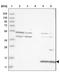 Cytochrome B561 Family Member D1 antibody, NBP1-83468, Novus Biologicals, Western Blot image 