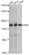 Radixin antibody, A14777, ABclonal Technology, Western Blot image 