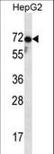 Zona Pellucida Glycoprotein 1 antibody, LS-C157521, Lifespan Biosciences, Western Blot image 