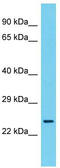 Armadillo Repeat Containing 7 antibody, TA330740, Origene, Western Blot image 