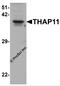 THAP Domain Containing 11 antibody, 7613, ProSci, Western Blot image 