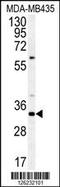 SAGA Complex Associated Factor 29 antibody, MBS9210115, MyBioSource, Western Blot image 