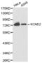 Potassium Voltage-Gated Channel Subfamily D Member 2 antibody, abx001293, Abbexa, Western Blot image 