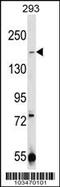 Transient Receptor Potential Cation Channel Subfamily M Member 7 antibody, 63-368, ProSci, Western Blot image 