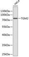 Transglutaminase 2 antibody, 13-295, ProSci, Western Blot image 
