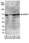 Cleavage Stimulation Factor Subunit 2 Tau Variant antibody, A301-487A, Bethyl Labs, Western Blot image 