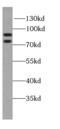 Spartin antibody, FNab08155, FineTest, Western Blot image 
