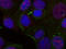 Proto-oncogene c-Rel antibody, STJ22374, St John