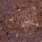 Ribosomal Protein L8 antibody, NBP2-48827, Novus Biologicals, Immunohistochemistry paraffin image 