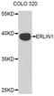 ER Lipid Raft Associated 1 antibody, STJ26674, St John