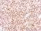 Proteasome 26S Subunit, ATPase 6 antibody, NBP2-19985, Novus Biologicals, Immunohistochemistry frozen image 