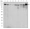 Protein Kinase N2 antibody, STJ98336, St John
