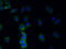 Transmembrane Protein 38B antibody, A61418-100, Epigentek, Immunofluorescence image 