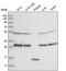 Clathrin Light Chain B antibody, NBP2-55390, Novus Biologicals, Western Blot image 