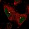 Katanin Catalytic Subunit A1 antibody, HPA036207, Atlas Antibodies, Immunofluorescence image 