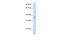 Cellular Communication Network Factor 3 antibody, 29-896, ProSci, Western Blot image 