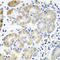 Plastin 3 antibody, STJ25032, St John