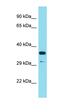 R-Spondin 3 antibody, orb326365, Biorbyt, Western Blot image 