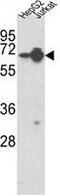 Heterogeneous Nuclear Ribonucleoprotein L antibody, GTX81941, GeneTex, Western Blot image 