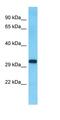 SLX1 Homolog B, Structure-Specific Endonuclease Subunit antibody, orb327107, Biorbyt, Western Blot image 