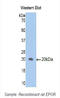 Erythropoietin Receptor antibody, LS-C299722, Lifespan Biosciences, Western Blot image 