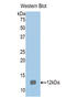 S100 Calcium Binding Protein A1 antibody, LS-C299410, Lifespan Biosciences, Western Blot image 