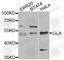 Galactosidase Alpha antibody, A1700, ABclonal Technology, Western Blot image 