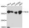 Tubulin Folding Cofactor B antibody, A07032, Boster Biological Technology, Western Blot image 