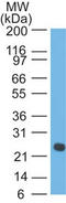 Ig lambda-1 chain C regions antibody, AM50121PU-T, Origene, Western Blot image 