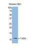 Interleukin 6 Receptor antibody, LS-C299895, Lifespan Biosciences, Western Blot image 