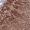Suppression Of Tumorigenicity 7 antibody, HPA038326, Atlas Antibodies, Immunohistochemistry paraffin image 
