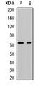 Cytochrome P450 Family 51 Subfamily A Member 1 antibody, orb378024, Biorbyt, Western Blot image 
