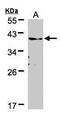 Transmembrane Protein 59 antibody, PA5-21575, Invitrogen Antibodies, Western Blot image 