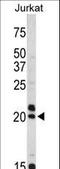 Vasoactive Intestinal Peptide antibody, LS-B3634, Lifespan Biosciences, Western Blot image 