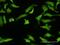 Zinc Finger Protein 287 antibody, H00057336-M08, Novus Biologicals, Immunocytochemistry image 