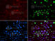 MutS Homolog 6 antibody, A3177, ABclonal Technology, Immunofluorescence image 