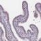 Proteasome Subunit Beta 5 antibody, NBP2-13820, Novus Biologicals, Immunohistochemistry paraffin image 